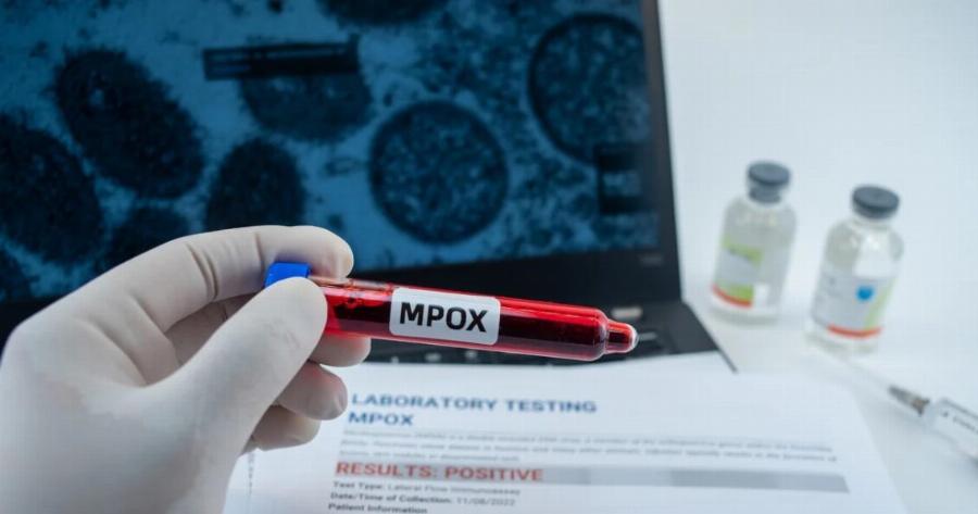 Συναγερμός στον ΕΟΔΥ: Επιβεβαιώθηκαν 18 κρούσματα – Τα συμπτώματα που σoκάρoυν