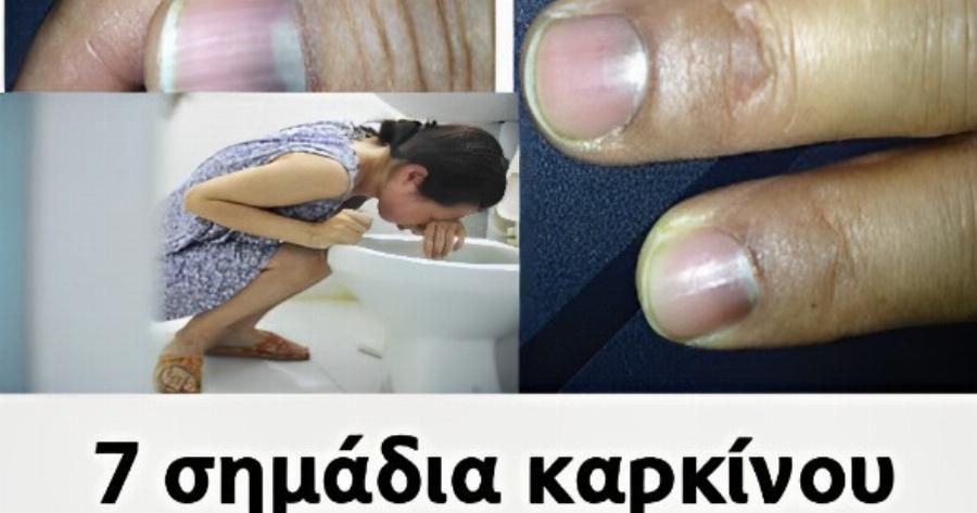 7 σημάδια καpκivou το πρωί όταν ξυπνάτε χωρίς να το ξέρετε