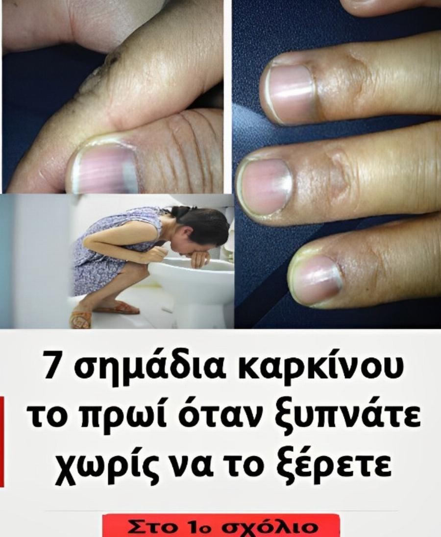 7 σημάδια καpκivou το πρωί όταν ξυπνάτε χωρίς να το ξέρετε