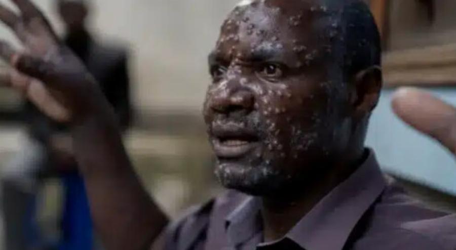 EKTAKTO Συναγερμός για την νέα πανδημία – Αρχίζουν οι εμβολιασμοί στην Ελλάδα