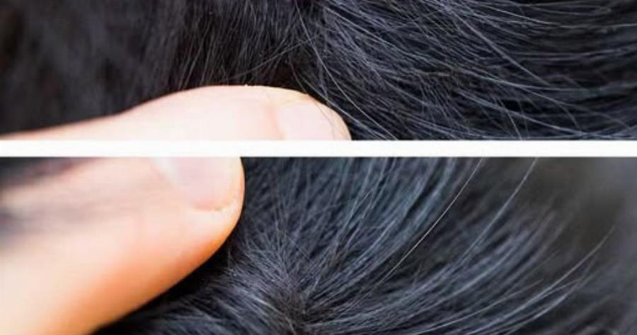 Μόλις ανακάλυψα αυτό στα μαλλιά του γιου μου. Τι είναι αυτό; Δεν είμαι σίγουρη αν πρέπει να πάμε στο γιατρό