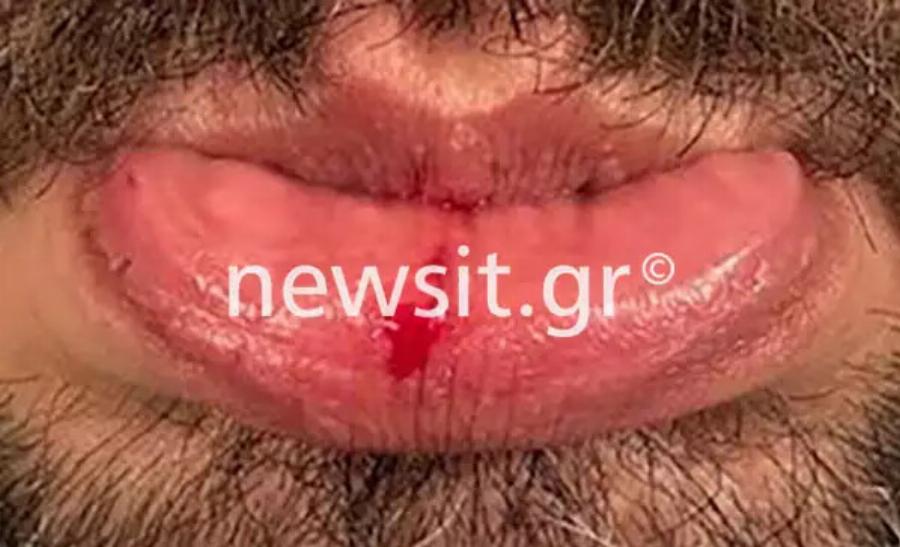 Γνωστός επιχειρηματίας πήρε γλυκό από πασίγνωστο ζαχαροπλαστείο στα Ν. Προάστια κι έπαθε σοκ με αυτό που βρήκε μέσα