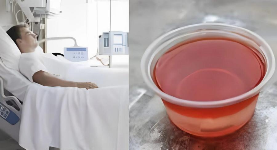 Λύθηκε το μυστήριο: Ποιος είναι ο λόγος που σερβίρουν ζελέ στα νοσοκομεία