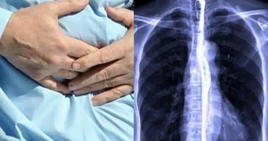 23χρονος έζησε τον απόλυτο εφιάλτη: Είχε έντονους πόνους στο στομάχι και αυτό που ζούσε μέσα του ήταν σκέτη φρίκη