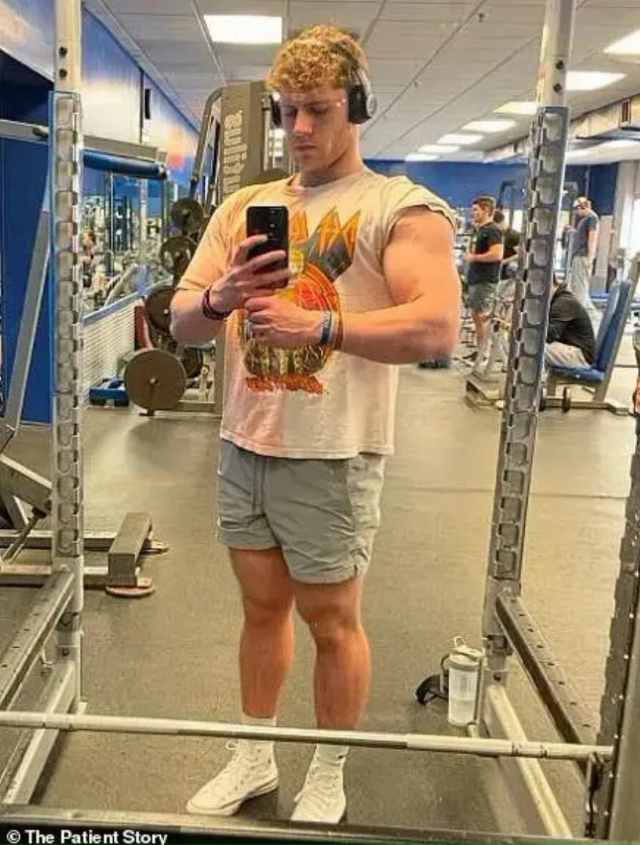 21χρονος βρέθηκε γεμάτος όγκους – Οι γιατροί του έλεγαν ότι είναι «τσούξιμο» από το πολύ γυμναστήριο