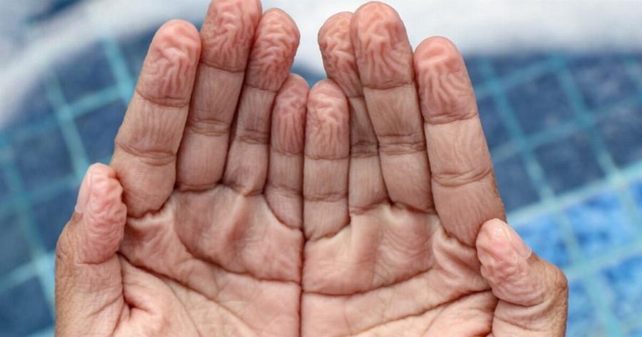 ΠΡΟΣOXH: Αν ζαρώνουν αμέσως τα δάχτυλά σας στο νερό τότε ίσως έχετε…