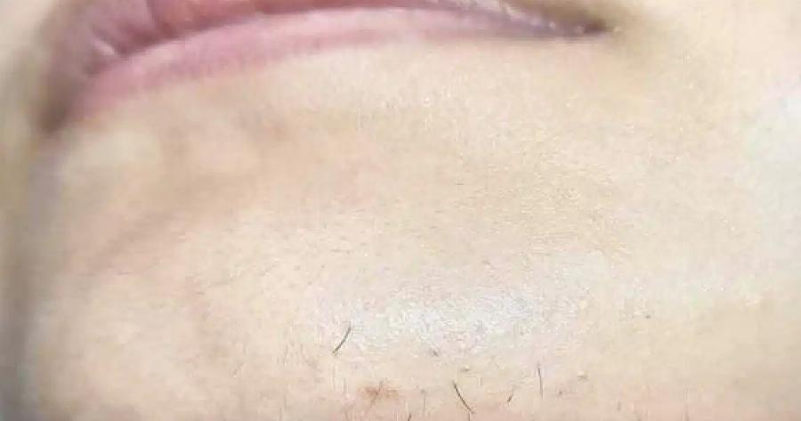 Αν είστε γυναίκα με γένια στο σαγόνι να τι σημαίνει για εσάς