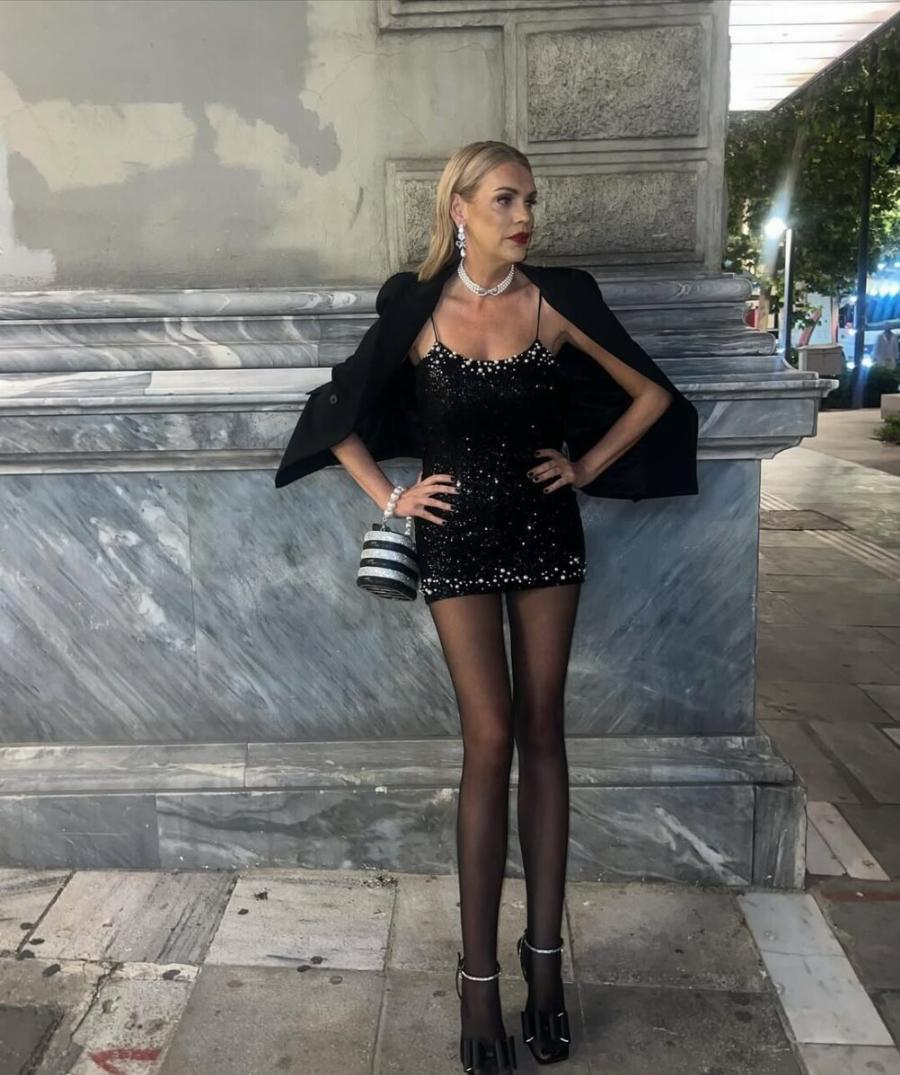 Η διάσημη Ελληνίδα «άγαλμα» με τα πιο μακριά πόδια στην Ελλάδα