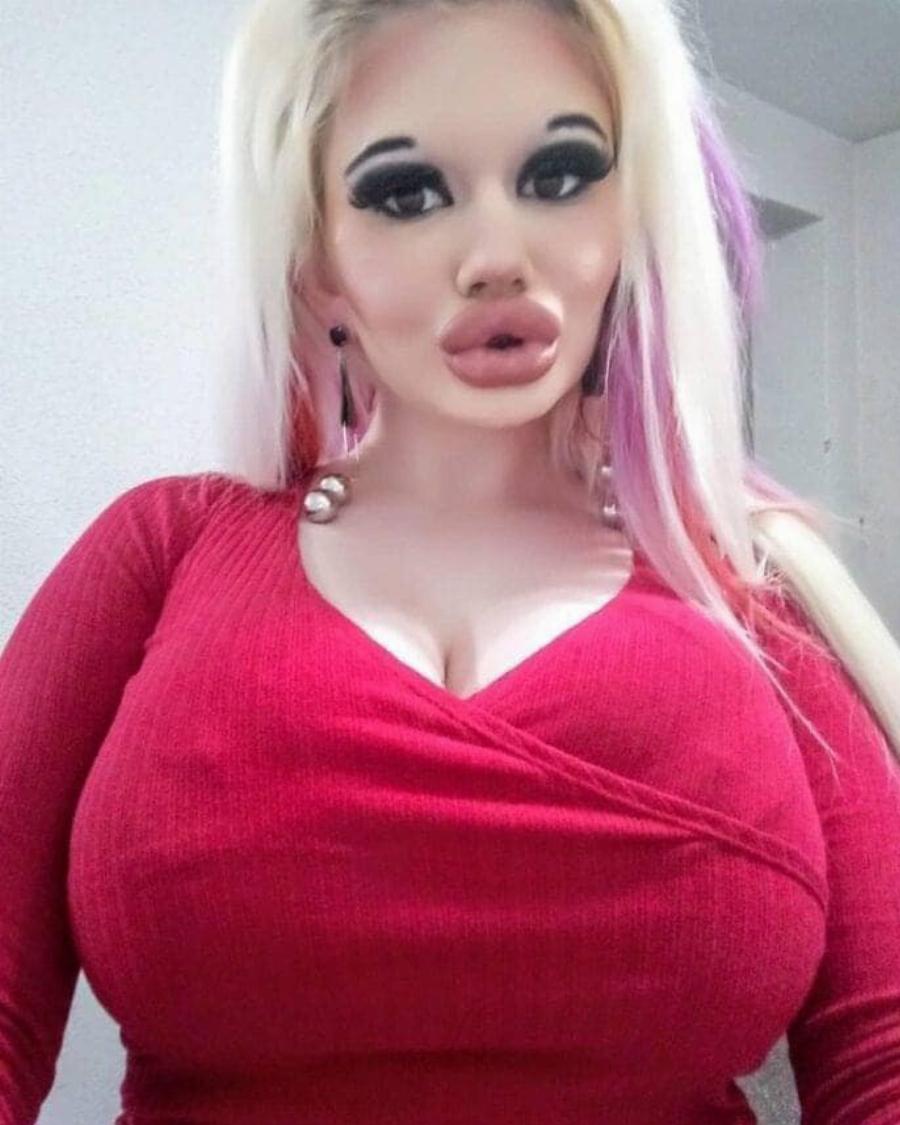 Η κοπέλα θα μπορούσε να γίνει Μις Βουλγαρία πριν από τις επεμβάσεις. Αλλά σίγουρα όχι τώρα