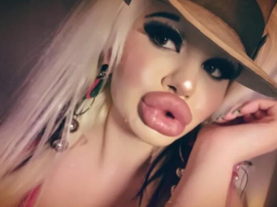 Η κοπέλα θα μπορούσε να γίνει Μις Βουλγαρία πριν από τις επεμβάσεις. Αλλά σίγουρα όχι τώρα