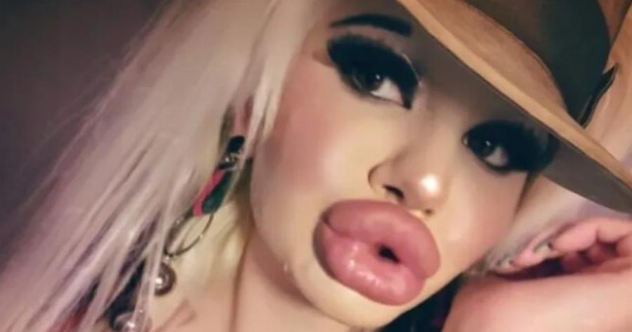 Η κοπέλα θα μπορούσε να γίνει Μις Βουλγαρία πριν από τις επεμβάσεις. Αλλά σίγουρα όχι τώρα