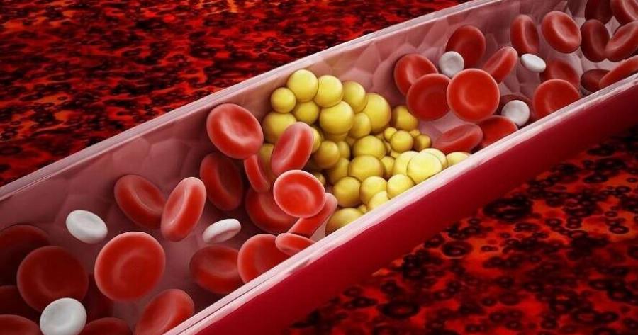 Το «θαυματουργό» λαχανικό που κάνει καλό στο δέρμα και ρίχνει τη χοληστερόλη