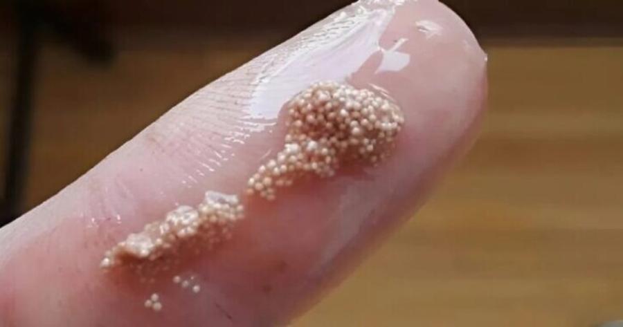 Βρήκα αυτές τις μικρές γλοιώδεις μπάλες μέσα στο αυγό και νόμιζα ότι ήταν αυγά εντόμων, αλλά μετά έμαθα την φρικτή αλήθεια και σοκαρίστηκα.