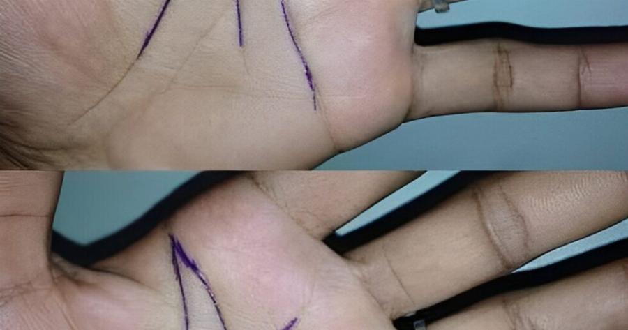 Τι σημαίνει όταν σχηματίζεται το γράμμα «Μ» στην παλάμη σας: Το μυστικό νόημα