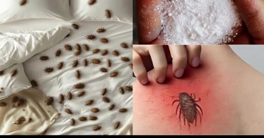 Πώς να αφαιρέσετε τα ακάρεα της σκόνης και τους κοριούς από το στρώμα σας με φυσικό τρόπο
