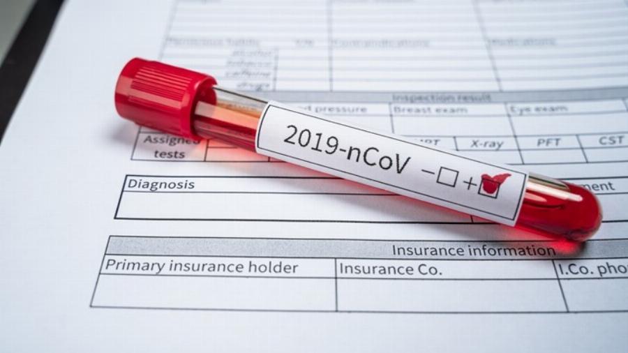 Rapid test σήμερα: Στο 1,4% η θετικότητα – Δείτε σε ποιες περιοχές γίνονται σήμερα δωρεάν τεστ