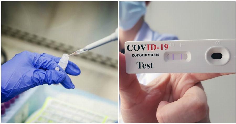 Rapid tests ΕΟΔΥ: Εντοπίστηκαν 25 κρούσματα σε 974 τεστ ταχείας ανίχνευσης αντιγόνου