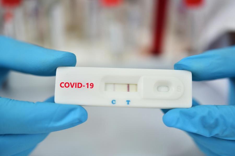 Δωρεάν rapid tests: Εντοπίστηκαν 19 κρούσματα σε 537 τεστ ταχείας ανίχνευσης αντιγόνου από τον ΕΟΔΥ