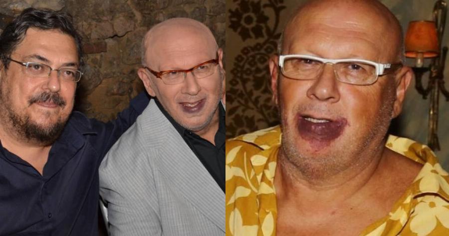 Λάκης Παπαδόπουλος: Η αλήθεια για το σημάδι στο πρόσωπο, η τεράστια καριέρα και το επάγγελμα του  γιου του