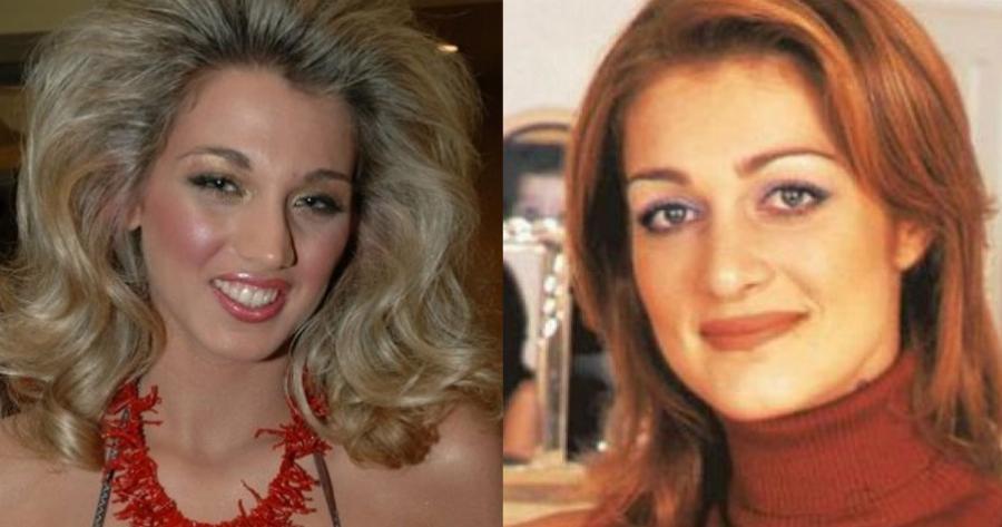 Εφτά διάσημες γυναίκες πριν και μετά την πλαστική εγχείρηση μύτης