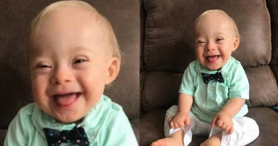 Το γελαστό μωρό με Σύνδρομο Down, πρεσβευτής παιδικών τροφών