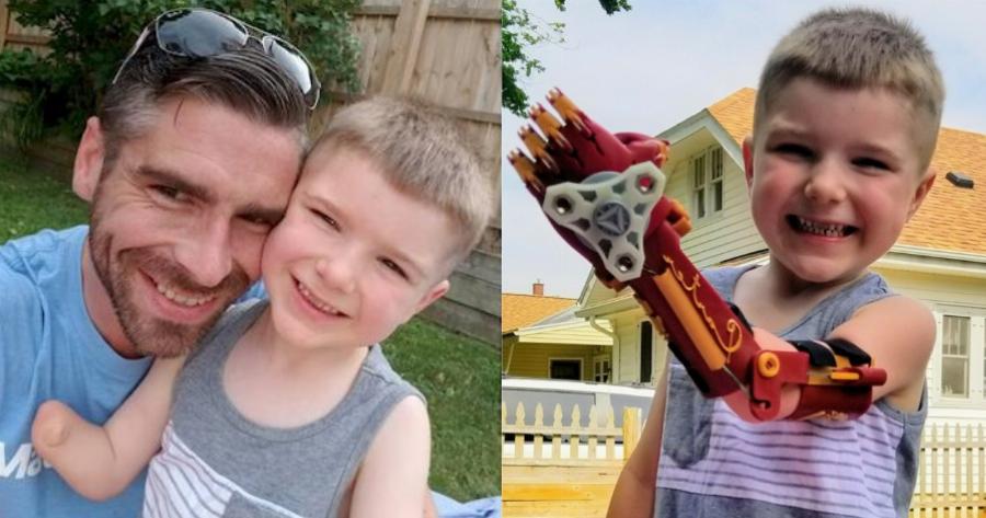 Σούπερ μπαμπάς φτιάχνει μηχανικά χέρια και τα προσφέρει δωρεάν σε παιδιά που τα έχουν ανάγκη