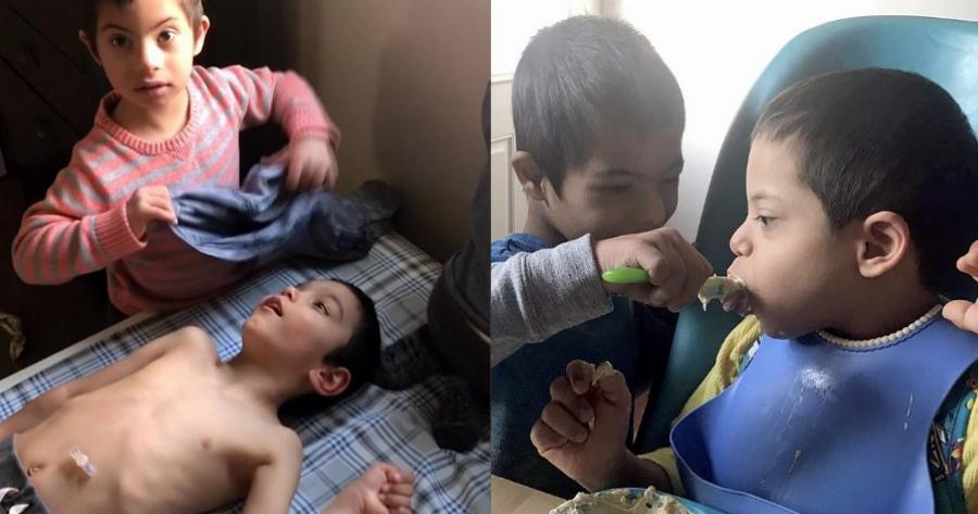 Παιδί 4 ετών με Σύνδρομο Down φροντίζει τα τρία ανάπηρα αδέλφια του και συγκινεί το διαδίκτυο