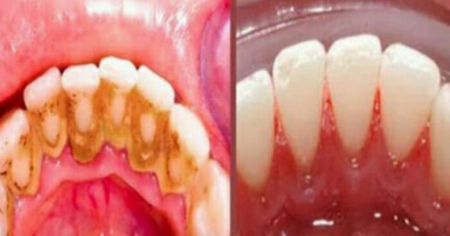 Πέτρα: Το απλό κόλπο των παλιών νοικοκυρών που μπορεί να φανεί χρήσιμο μέχρι και σήμερα