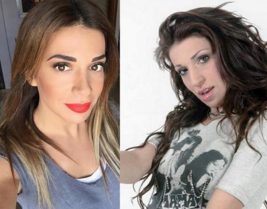 Εφτά διάσημες γυναίκες πριν και μετά την πλαστική εγχείρηση μύτης