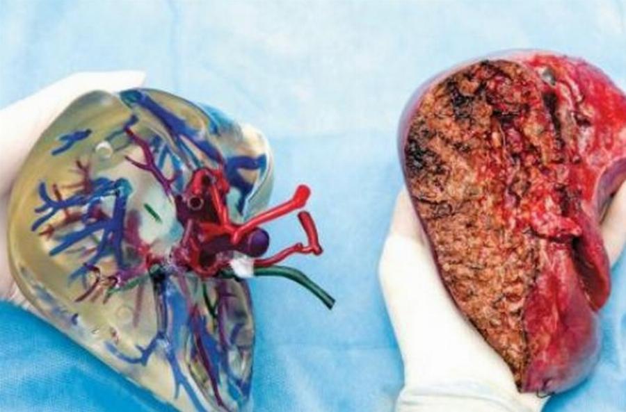 Πέτρος Μπαγγέας: Ο νεαρός Έλληνας χειρούργος που επινόησε πατέντα που αλλάζει για πάντα την παγκόσμια ιατρική