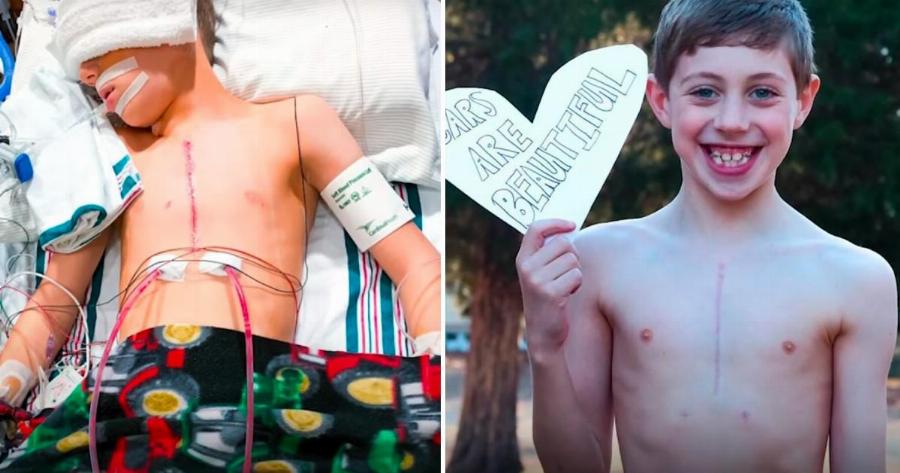 Πρωτοποριακή εγχείρηση χάρισε μια υγιή ζωή σε παιδί που ήταν καταδικασμένο