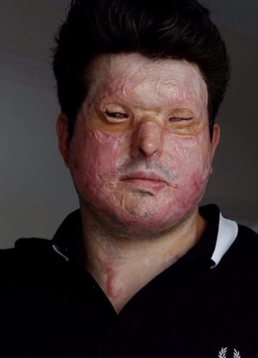 Η αληθινή ιστορία του Ανδρέα: Ένας άγνωστος του κατέστρεψε τη ζωή, επειδή τον εκδικήθηκε από λάθος