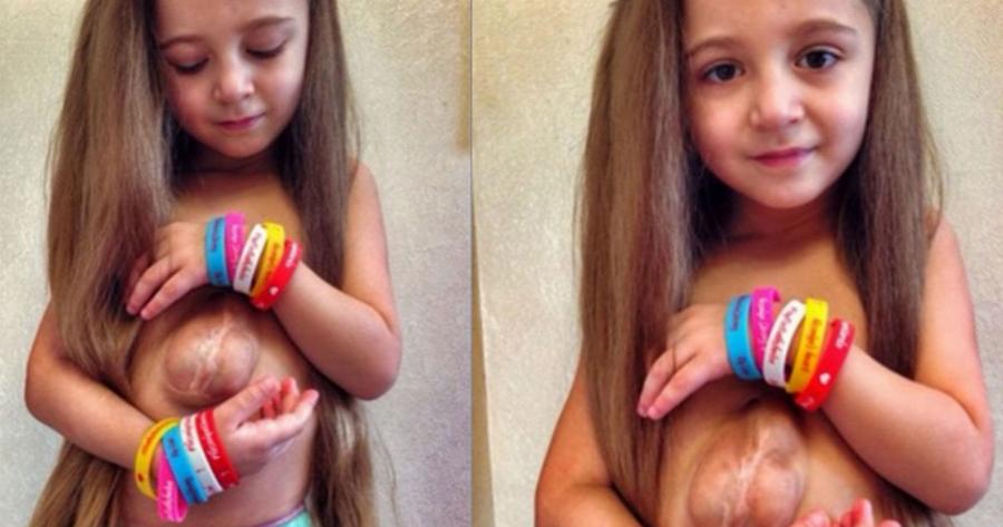 Κoρίτσι γεννήθηκε με την καρδιά έξω από το στήθος: Δείτε σε Βίντεο με τι θαρραλέο τρόπο ζει.