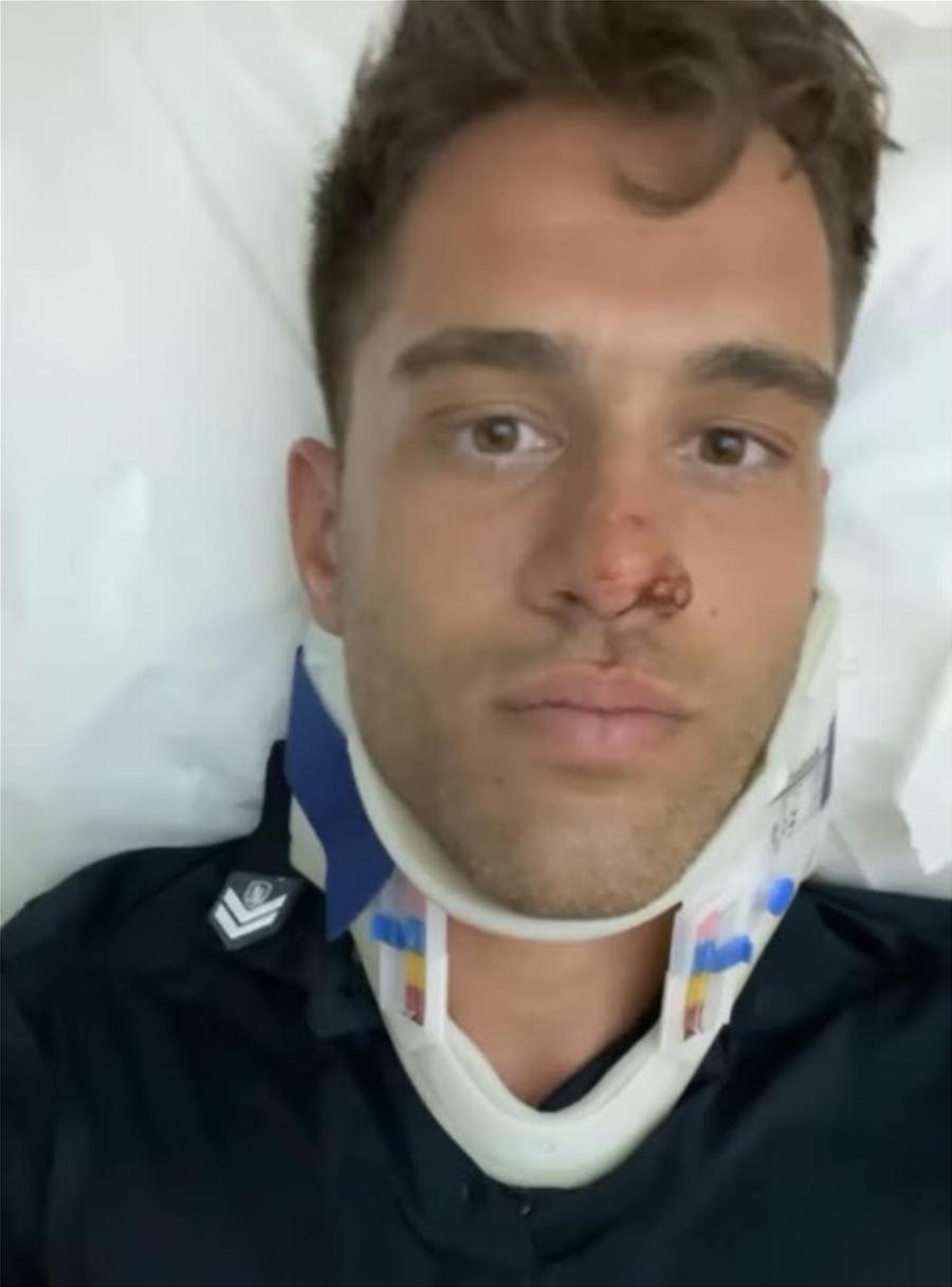 Αστυνομικός έπεσε από ύψος 10 μέτρων προσπαθώντας να συλλάβει διαρρήκτη