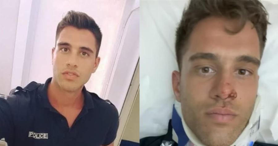 Αστυνομικός έπεσε από ύψος 10 μέτρων προσπαθώντας να συλλάβει διαρρήκτη