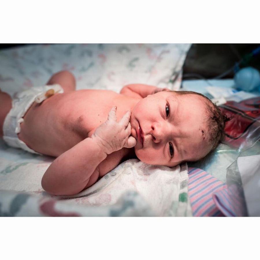 Μωρό γεννήθηκε γεμάτο μαλλιά και με μεγάλο χαμόγελο και οι φωτογραφίες τρελαίνουν το διαδίκτυο