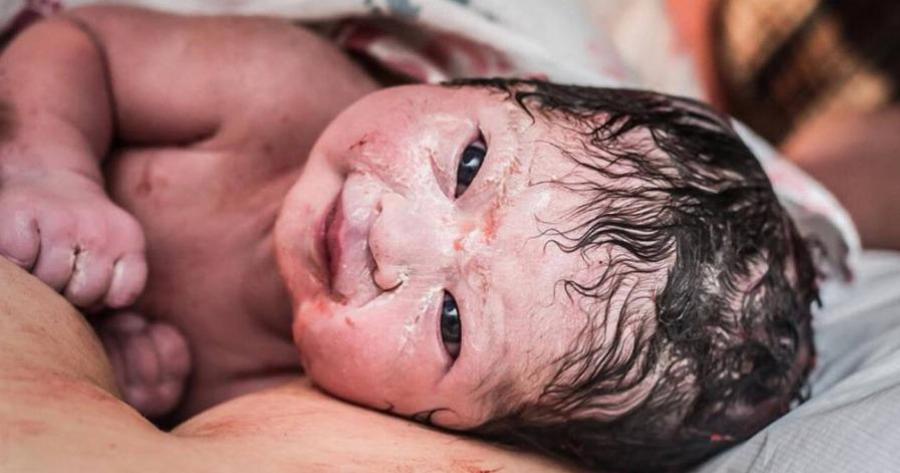 Μωρό γεννήθηκε γεμάτο μαλλιά και με μεγάλο χαμόγελο και οι φωτογραφίες τρελαίνουν το διαδίκτυο