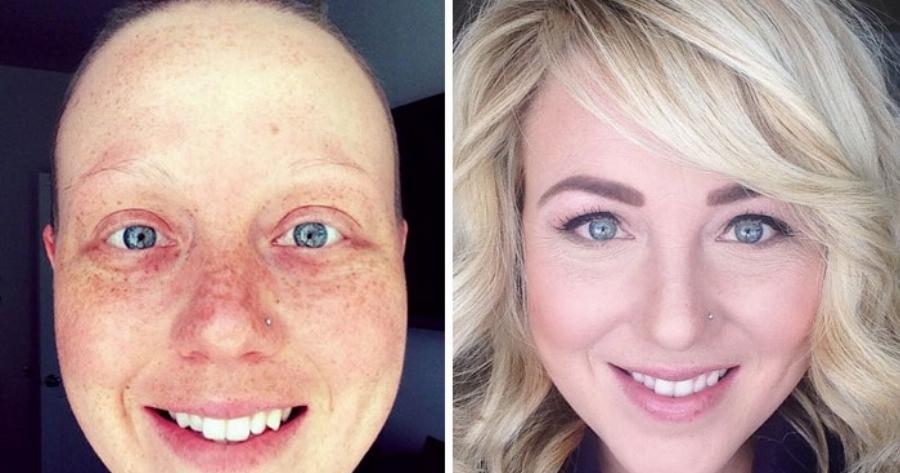 Όλα παλεύονται σε αυτή τη ζωή. Ακόμη κι ο καρκίνος. Και ας μην το πιστεύεις