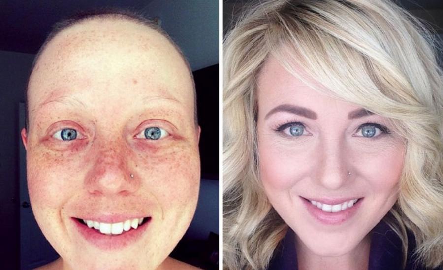 Όλα παλεύονται σε αυτή τη ζωή. Ακόμη κι ο καρκίνος. Και ας μην το πιστεύεις