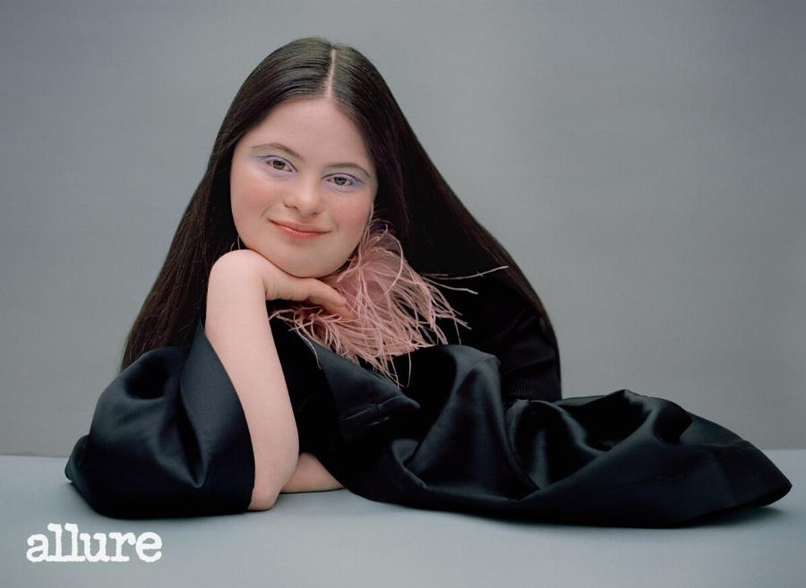 Το νέο μοντέλο του οίκου Gucci είναι ένα υπέροχο κορίτσι με σύνδρομο Down