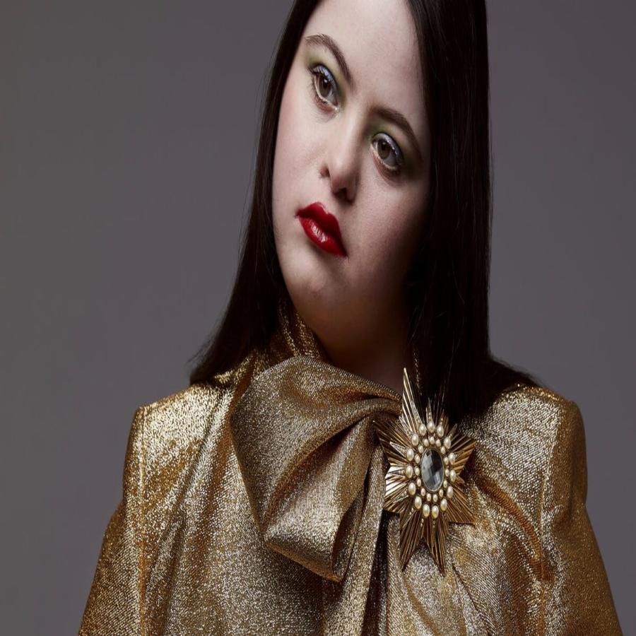 Το νέο μοντέλο του οίκου Gucci είναι ένα υπέροχο κορίτσι με σύνδρομο Down