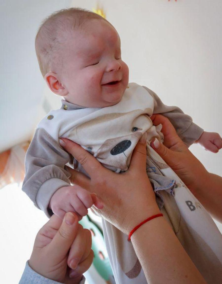 Το γελαστό μωρό χωρίς μάτια βρήκε σπίτι – Το εγκατέλειψε η μητέρα του μόλις γεννήθηκε