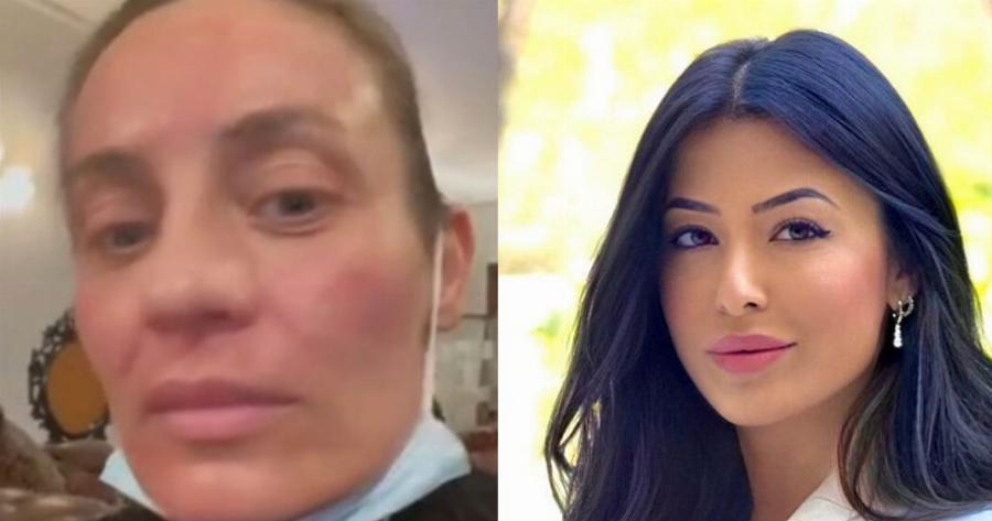 Η Μελέτη “τέλειωσε” τη Λατινοπούλου σε 1 λεπτό: «Πάρε τις αντιαισθητικές πανάδες μου»