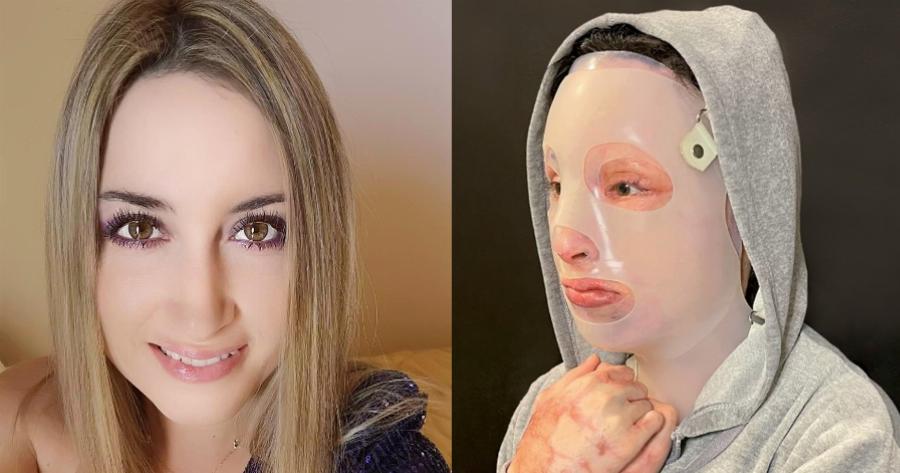 Το οργισμένο ξέσπασμα της Ιωάννας που δέχθηκε επίθεση με βιτριόλι κατά του πιλότου