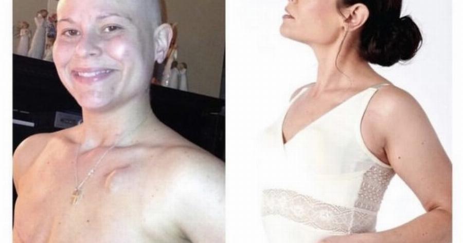 Σήμερα είμαι 8 χρόνια ελεύθερη καρκίνου