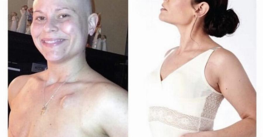 Σήμερα είμαι 8 χρόνια ελεύθερη καρκίνου