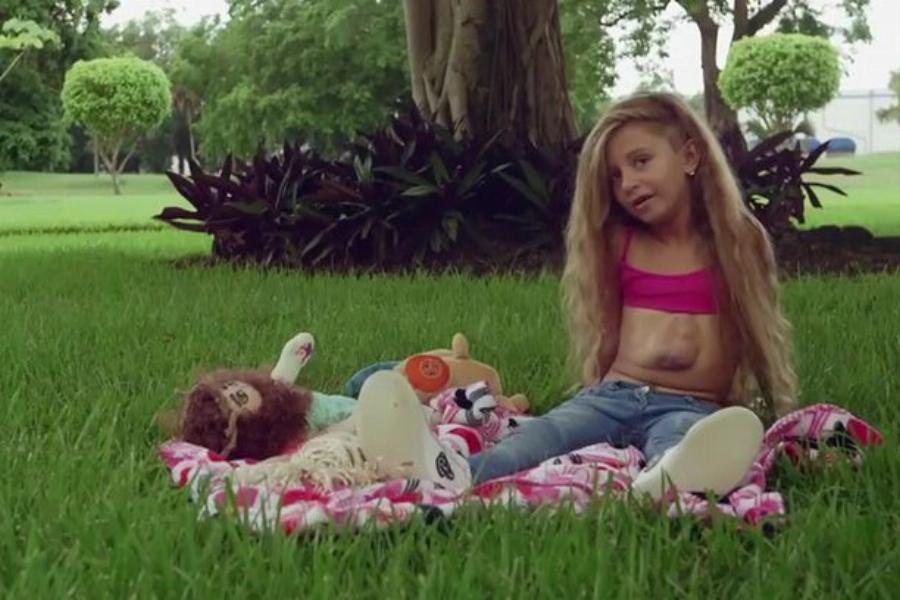 Κoρίτσι γεννήθηκε με την καρδιά έξω από το στήθος: Δείτε σε Βίντεο με τι θαρραλέο τρόπο ζει.