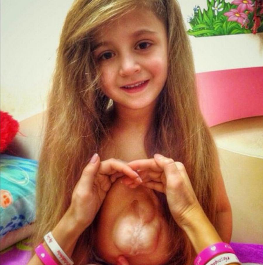 Κoρίτσι γεννήθηκε με την καρδιά έξω από το στήθος: Δείτε σε Βίντεο με τι θαρραλέο τρόπο ζει.