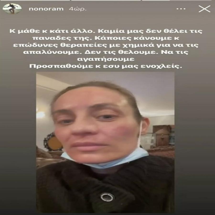 Η Μελέτη “τέλειωσε” τη Λατινοπούλου σε 1 λεπτό: «Πάρε τις αντιαισθητικές πανάδες μου»