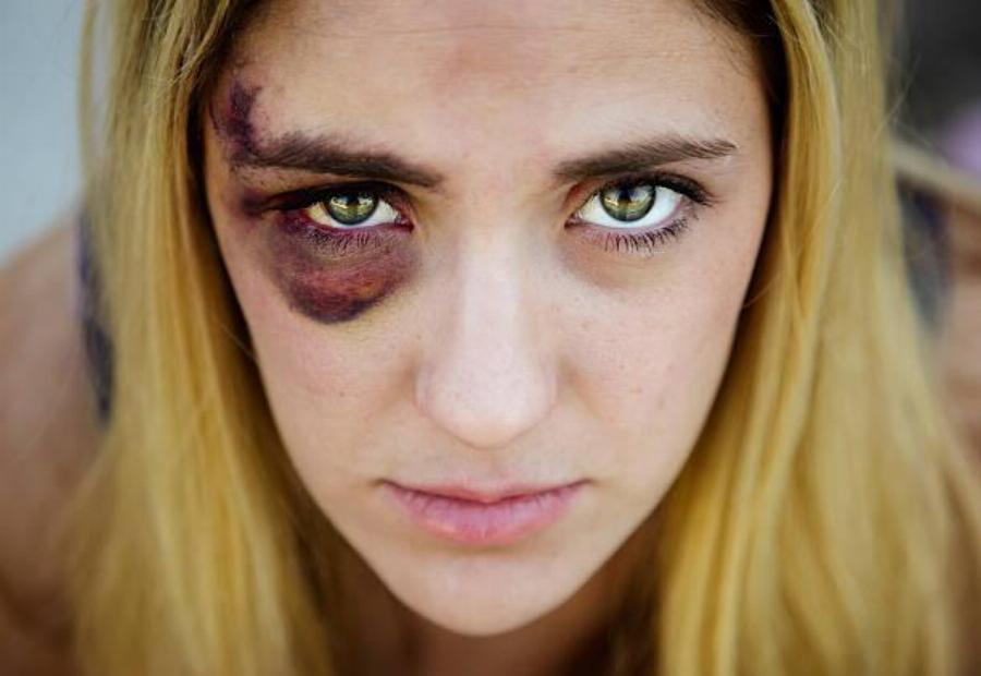 Αν βλέπατε την αδερφή σας ή την κόρη σας με μαυρισμένο μάτι από τον γαμπρό… τι θα κάνατε;